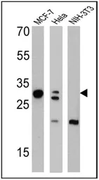 Anti-Galectin 3 antibody [A3A12] used in Western Blot (WB). GTX22785