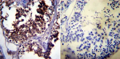Anti-Hsp70 antibody [5A5] used in IHC (Paraffin sections) (IHC-P). GTX22787