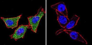Anti-Hsp70 antibody [5A5] used in Immunocytochemistry/ Immunofluorescence (ICC/IF). GTX22787