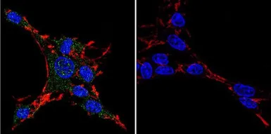 Anti-HSP27 antibody [G3.1] used in Immunocytochemistry/ Immunofluorescence (ICC/IF). GTX22790