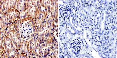 Anti-TCP1 alpha antibody [91A] used in IHC (Paraffin sections) (IHC-P). GTX22797