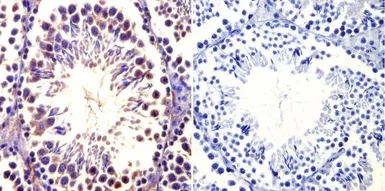 Anti-TCP1 alpha antibody [91A] used in IHC (Paraffin sections) (IHC-P). GTX22797