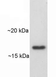 Anti-ARF1/ARF3/ARF5/ARF6 antibody [1D9] used in Western Blot (WB). GTX22806