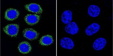 Anti-ARF1/ARF3/ARF5/ARF6 antibody [1D9] used in Immunocytochemistry/ Immunofluorescence (ICC/IF). GTX22806