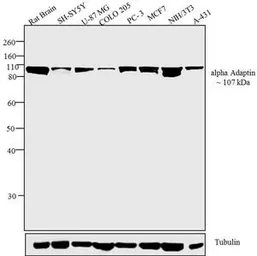 Anti-alpha Adaptin antibody [AC1-M11] used in Western Blot (WB). GTX22807