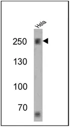 Anti-Spectrin beta 1 antibody [4C3] used in Western Blot (WB). GTX22808