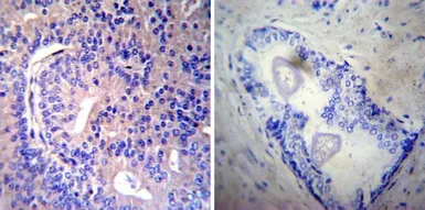 Anti-Rab9 antibody [Mab9] used in IHC (Paraffin sections) (IHC-P). GTX22810