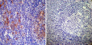 Anti-Rab9 antibody [Mab9] used in IHC (Paraffin sections) (IHC-P). GTX22810