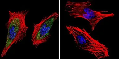 Anti-Rab9 antibody [Mab9] used in Immunocytochemistry/ Immunofluorescence (ICC/IF). GTX22810