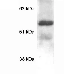 Anti-MECP2 antibody used in Western Blot (WB). GTX22828