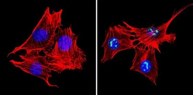 Anti-MECP2 antibody used in Immunocytochemistry/ Immunofluorescence (ICC/IF). GTX22828