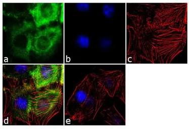 Anti-COPB antibody used in Immunocytochemistry/ Immunofluorescence (ICC/IF). GTX22915