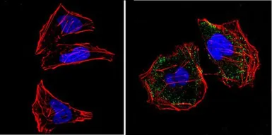 Anti-RASA1 antibody [B4F8] used in Immunocytochemistry/ Immunofluorescence (ICC/IF). GTX22922