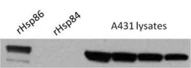 Anti-Hsp90 alpha antibody used in Western Blot (WB). GTX22928