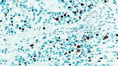Anti-Topoisomerase II alpha antibody [3F6] used in IHC (Paraffin sections) (IHC-P). GTX23111