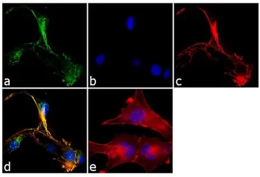 Anti-SNAP23 antibody used in Immunocytochemistry/ Immunofluorescence (ICC/IF). GTX23340