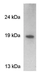 Anti-VAMP2 antibody used in Western Blot (WB). GTX23347