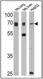 Anti-PMP70 antibody used in Western Blot (WB). GTX23421