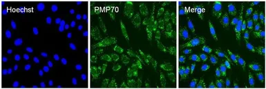 Anti-PMP70 antibody used in Immunocytochemistry/ Immunofluorescence (ICC/IF). GTX23421