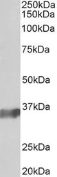Anti-BOB1 antibody used in Western Blot (WB). GTX23426