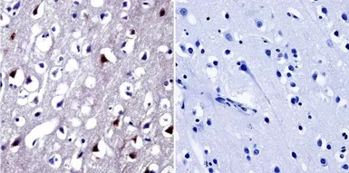 Anti-NFAT5 antibody used in IHC (Paraffin sections) (IHC-P). GTX23446