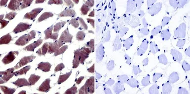 Anti-NFAT5 antibody used in IHC (Paraffin sections) (IHC-P). GTX23446