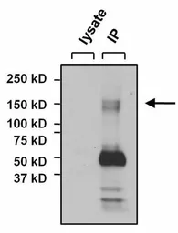 Anti-NFAT5 antibody used in Immunoprecipitation (IP). GTX23446