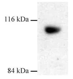 Anti-Dynamin 3 antibody used in Western Blot (WB). GTX23458