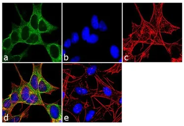 Anti-Dynamin 3 antibody used in Immunocytochemistry/ Immunofluorescence (ICC/IF). GTX23458