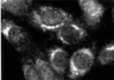 Anti-Furin antibody used in  (). GTX23467
