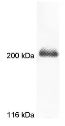 Anti-Myosin VIIa antibody used in Western Blot (WB). GTX23481
