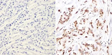 Anti-NCOR1 antibody used in IHC (Paraffin sections) (IHC-P). GTX23482