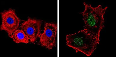 Anti-NCOR1 antibody used in Immunocytochemistry/ Immunofluorescence (ICC/IF). GTX23482