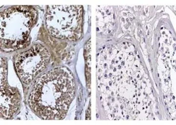 Anti-DNMT3L antibody used in Immunohistochemistry (IHC). GTX23493