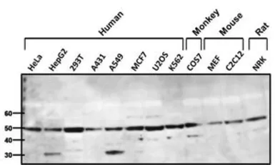 Anti-beta 1 Adrenergic Receptor antibody used in Western Blot (WB). GTX23546