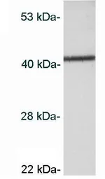 Anti-CaMK1 antibody used in Western Blot (WB). GTX23551