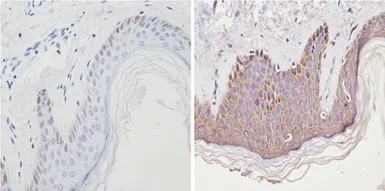 Anti-Cannabinoid receptor 2 antibody used in IHC (Paraffin sections) (IHC-P). GTX23561