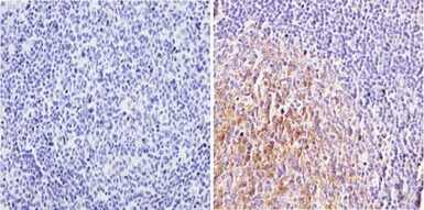 Anti-Cannabinoid receptor 2 antibody used in IHC (Paraffin sections) (IHC-P). GTX23561