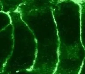 Anti-Cannabinoid receptor 2 antibody used in Immunocytochemistry/ Immunofluorescence (ICC/IF). GTX23561