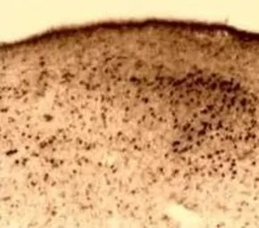 Anti-Estrogen Receptor beta antibody used in IHC (Paraffin sections) (IHC-P). GTX23577