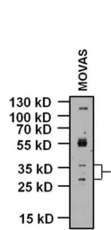 Anti-KCNMB1 antibody used in Western Blot (WB). GTX23587