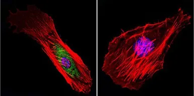 Anti-Calpain 1 antibody [9A4H8D3] used in Immunocytochemistry/ Immunofluorescence (ICC/IF). GTX23589