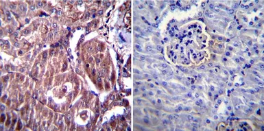 Anti-RAGE antibody used in IHC (Paraffin sections) (IHC-P). GTX23611