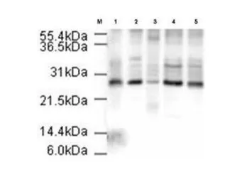 Anti-Apc10 antibody used in Western Blot (WB). GTX23629
