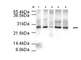 Anti-Apc10 antibody used in Western Blot (WB). GTX23629