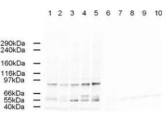 Anti-Ap2A antibody used in Western Blot (WB). GTX23707