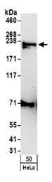 Anti-Claspin antibody used in Western Blot (WB). GTX23720