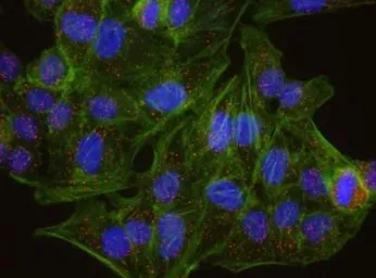 Anti-Claspin antibody used in Proximity ligation assay (PLA). GTX23720