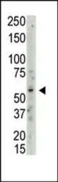 Anti-PRMT3 antibody used in Western Blot (WB). GTX23765
