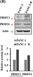 Anti-PRMT3 antibody used in Western Blot (WB). GTX23765